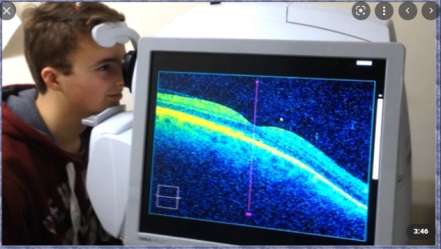 光學同調斷層掃描(OCT)在未來醫療檢測相關應用